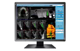 Монітор Eizo MX216-SB - Фото